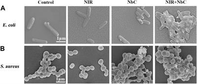 Niobium carbide–mediated photothermal therapy for infected wound treatment